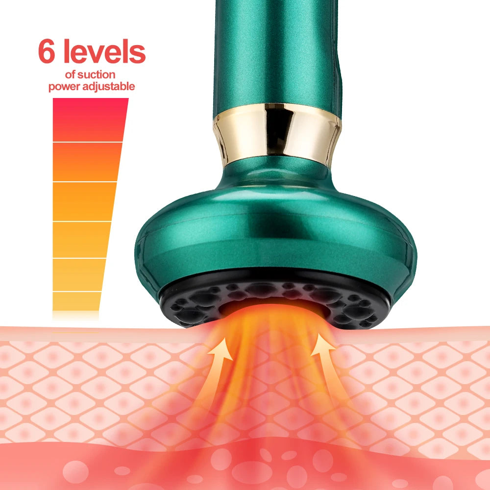 Cupping Vacuum
